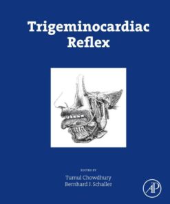 Trigeminocardiac Reflex eBook