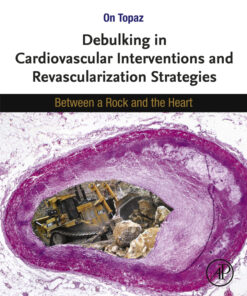 Debulking in Cardiovascular Interventions and Revascularization Strategies : Between a Rock and the Heart eBook