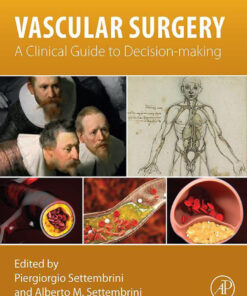 Vascular Surgery: A Clinical Guide to Decision-making eBook