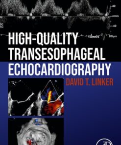 High-Quality Transesophageal Echocardiography eBook