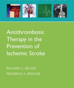 Antithrombotic Therapy in Prevention of Ischemic Stroke eBook