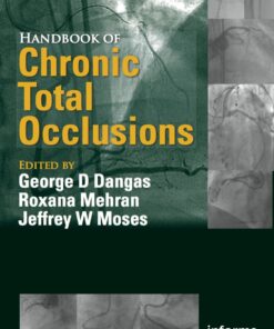 Handbook of Chronic Total Occlusions eBook
