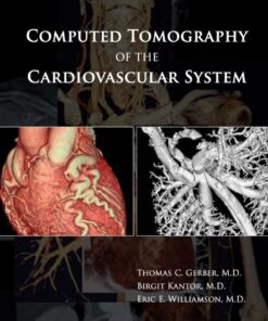 Computed Tomography of the Cardiovascular System eBook