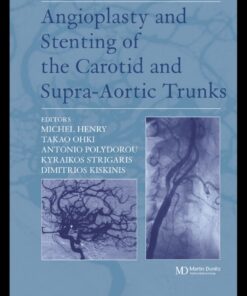 Angioplasty and Stenting of Carotid and Supra-aortic Trunks eBook