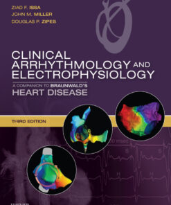 Clinical Arrhythmology and Electrophysiology E-Book: A Companion to Braunwald's Heart Disease eBook