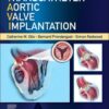Transcatheter Aortic Valve Implantation eBook