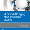 Multimodal Imaging Atlas of Cardiac Masses - E-Book eBook