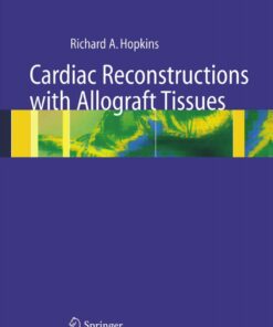 Cardiac Reconstructions with Allograft Tissues eBook