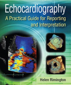 Echocardiography: A Practical Guide for Reporting and Interpretation, Third Edition eBook