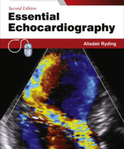 Essential Echocardiography: Expert Consult - Online & Print eBook