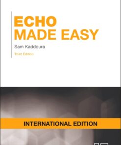 Echo Made Easy eBook