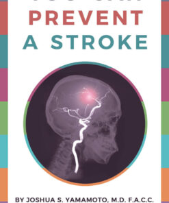 You Can Prevent a Stroke eBook