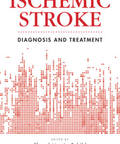 Ischemic Stroke: Diagnosis and Treatment eBook