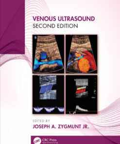 Venous Ultrasound eBook