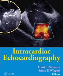 Intracardiac Echocardiography eBook