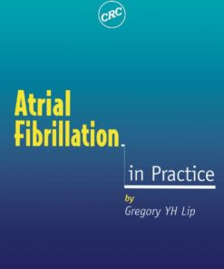 Atrial Fibrillation in Practice eBook
