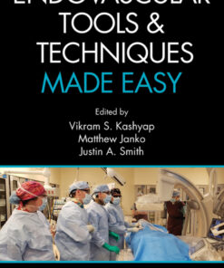 Endovascular Tools and Techniques Made Easy eBook