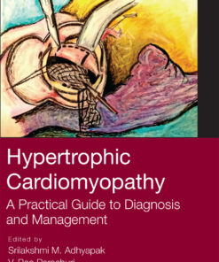 Hypertrophic Cardiomyopathy: A Practical Guide to Diagnosis and Management eBook