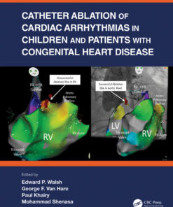 Catheter Ablation of Cardiac Arrhythmias in Children and Patients with Congenital Heart Disease eBook