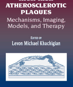 High-Risk Atherosclerotic Plaques: Mechanisms, Imaging, Models, and Therapy eBook