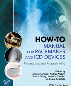 How-to Manual for Pacemaker and ICD Devices: Procedures and Programming eBook