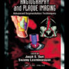 Angiography and Plaque Imaging: Advanced Segmentation Techniques eBook