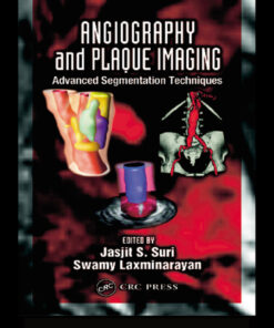 Angiography and Plaque Imaging: Advanced Segmentation Techniques eBook