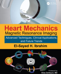 Heart Mechanics: Magnetic Resonance Imaging—Advanced Techniques, Clinical Applications, and Future Trends eBook