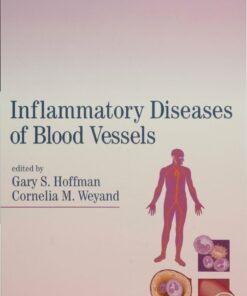 Inflammatory Diseases of Blood Vessels eBook