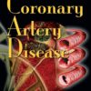 Risk Factors in Coronary Artery Disease eBook