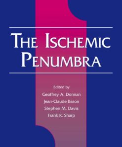 The Ischemic Penumbra eBook
