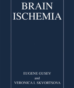 Brain Ischemia eBook