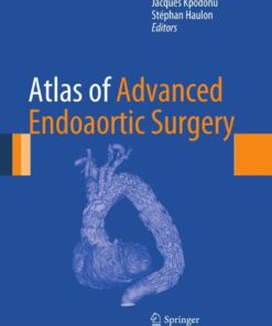Atlas of Advanced Endoaortic Surgery eBook