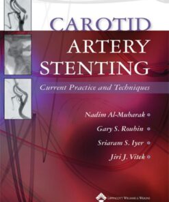 Carotid Artery Stenting: Current Practice and Techniques eBook