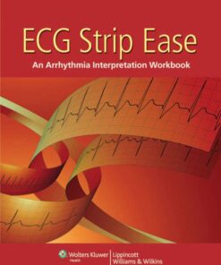 ECG Strip Ease eBook