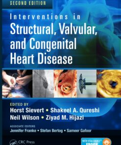 Interventions in Structural, Valvular and Congenital Heart Disease eBook