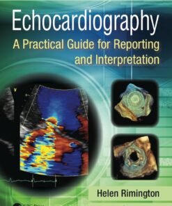 Echocardiography: A Practical Guide for Reporting and Interpretation, Third Edition eBook