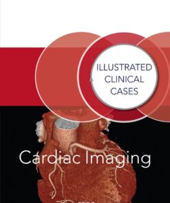 Cardiac Imaging: Illustrated Clinical Cases eBook
