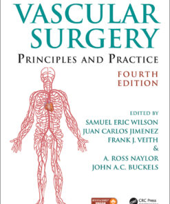 Vascular Surgery: Principles and Practice, Fourth Edition eBook