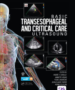 Basic Transesophageal and Critical Care Ultrasound eBook
