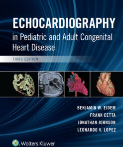 Echocardiography in Pediatric and Adult Congenital Heart Disease eBook