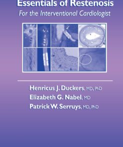 Essentials of Restenosis: For the Interventional Cardiologist eBook