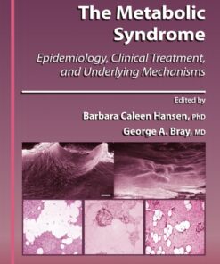The Metabolic Syndrome: Epidemiology, Clinical Treatment, and Underlying Mechanisms eBook