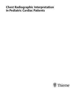 Chest Radiographic Interpretation in Pediatric Cardiac Patients eBook
