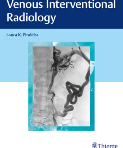 Venous Interventional Radiology eBook