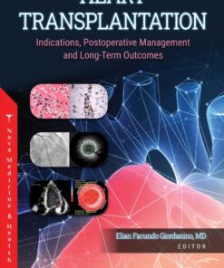 Heart Transplantation: Indications, Postoperative Management and Long-Term Outcomes eBook