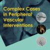 Complex Cases in Peripheral Vascular Interventions eBook
