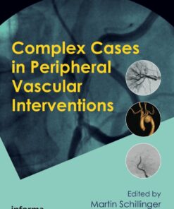 Complex Cases in Peripheral Vascular Interventions eBook