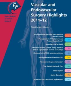 Fast Facts: Vascular and Endovascular Surgery Highlights 2011-12 eBook