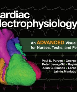 Cardiac Electrophysiology 2: An Advanced Visual Guide for Nurses, Techs, and Fellows eBook